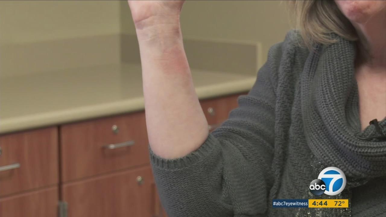 20 percent of people in US allergic to nickel, health experts say