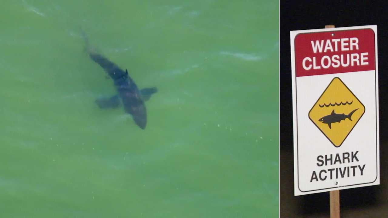 SoCal woman who survived shark attack in Corona del Mar speaks from