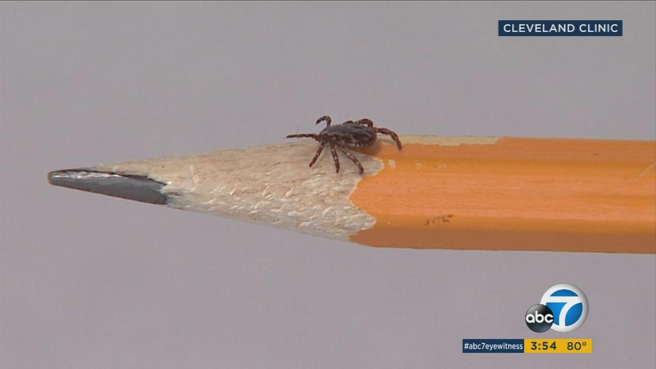 SoCal seeing increase in Lyme diseasecarrying ticks