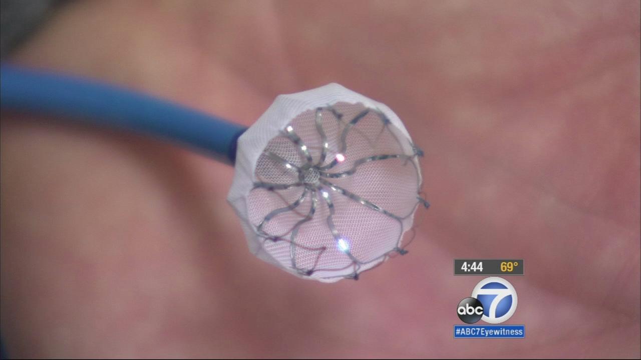 Watchman Implant Can Reduce Risk Of Stroke, Blood Clots | Abc7.com