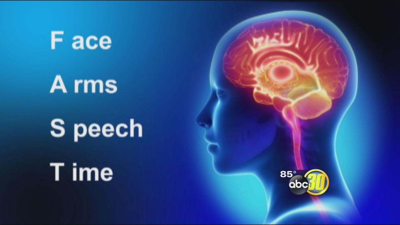 stroke-signs-think-fast-abc30