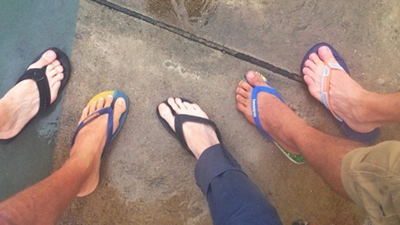 Doctors warn of flip flop health hazards