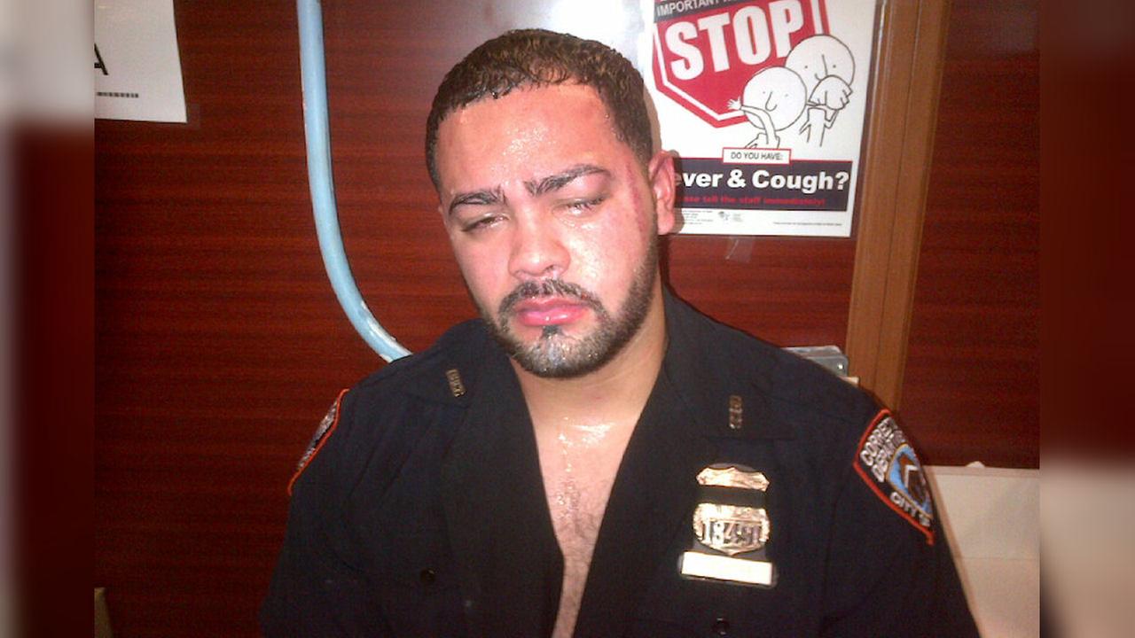 Correction Officer Allegedly Brutally Beaten By Inmate At Rikers Island