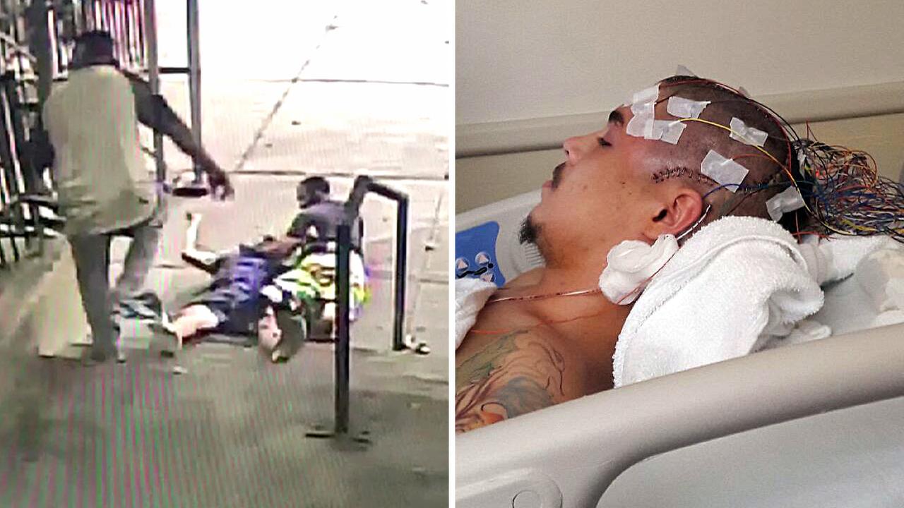 Video Man Tackled By Nypd Says Excessive Force During Arrest Caused Fractured Skull