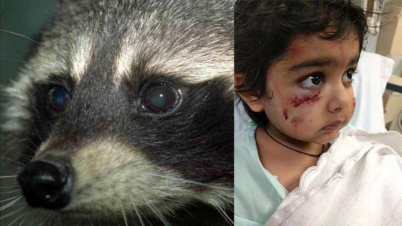 6-year-old boy attacked by raccoon in Elmwood Park, New ...