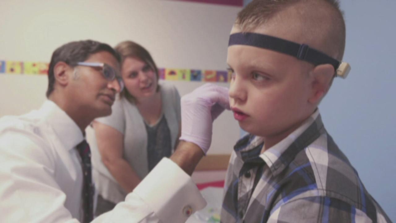 8-Year-Old Boy Born Without Ears Has the Sweetest Reaction to His Reconstructive Surgery 8-Year-Old Boy Born Without Ears Has the Sweetest Reaction to His Reconstructive Surgery
