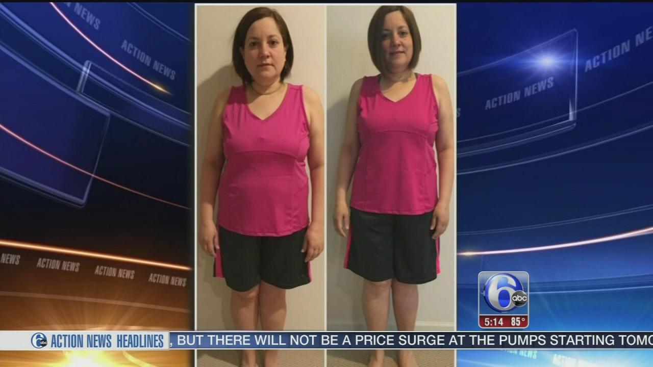 Reshape dual balloon: New weight loss procedure on market ...