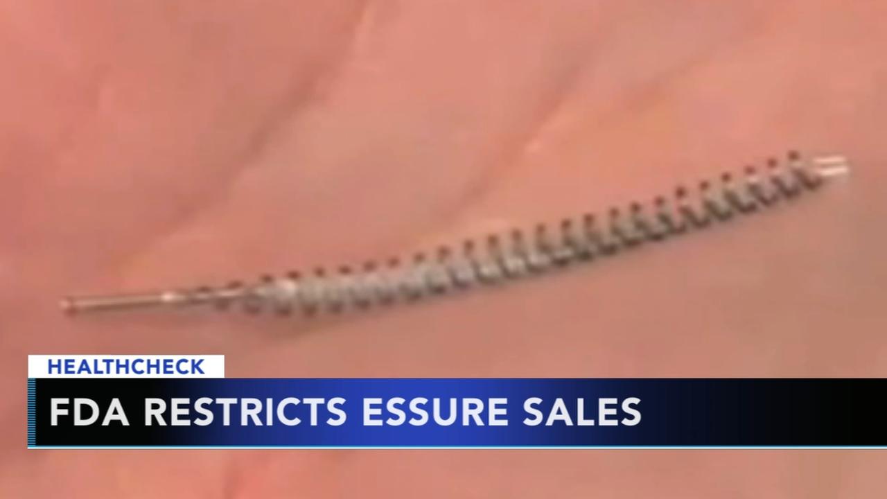 FDA restricts Essure birth control device sales